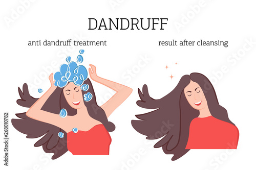 Treatment of dandruff and seborrhea, the concept of before and after