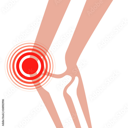 Orthopedic medical vector knee pain icons