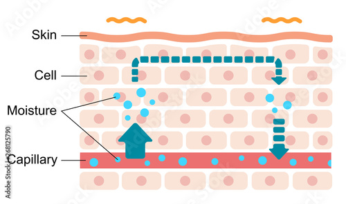 Illustration of swollen skin condition (Malfunction of moisture circulation).