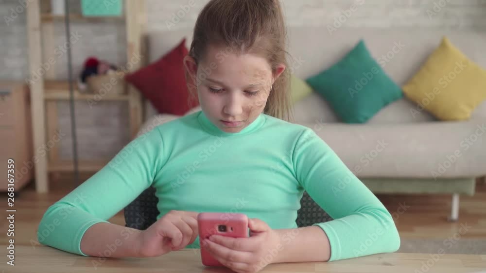 teenage girl with a facial defect uses a smartphone sitting at the table at home teenage girl with a facial defect uses a smartphone sitting at the table at home