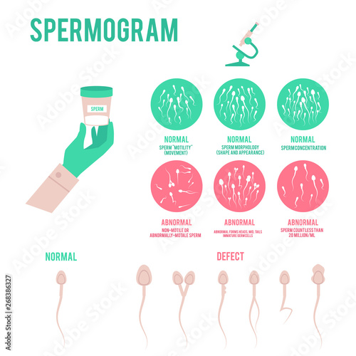 Spermogram analysis or test poster with microscope flat vector illustration.