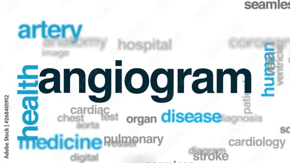 Angiogram animated word cloud. Kinetic typography. Angiogram animated word cloud. Kinetic typography.