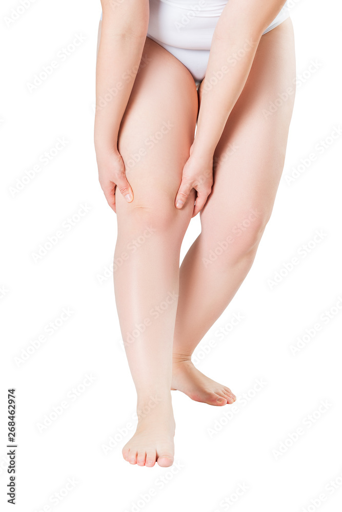 Fat female legs isolated on white background Fat female legs isolated on white background