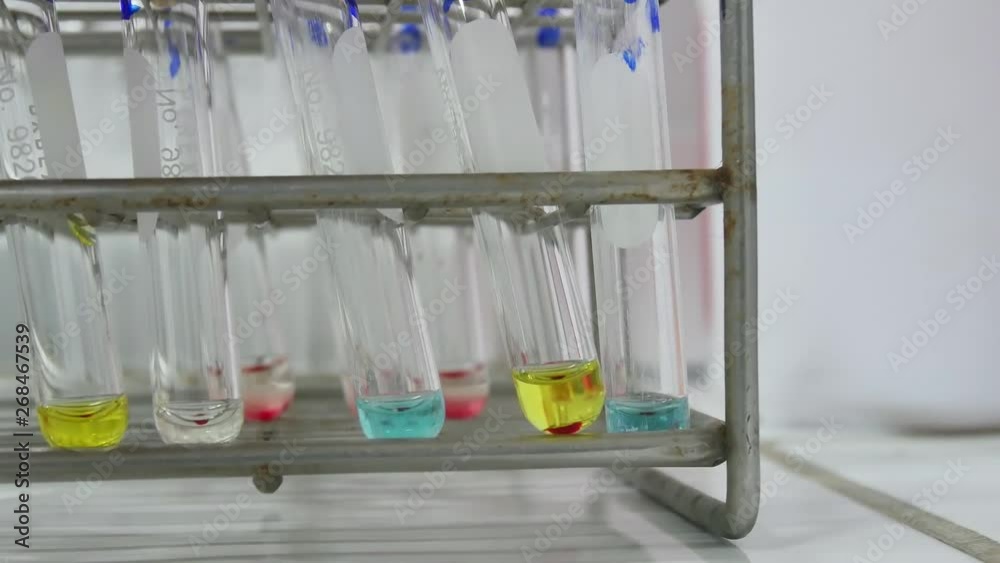 Test tube blood group testing in laboratory science concept. Test tube blood group testing in laboratory science concept.