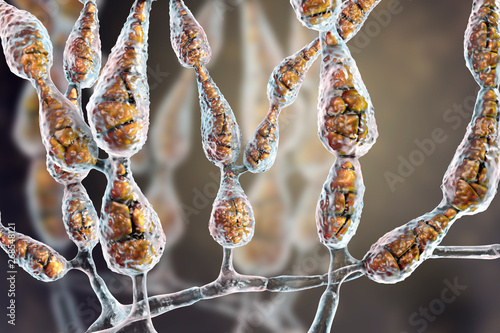 Mold Alternaria alternata, allergic fungus, 3D illustration. Alternaria is the causative agent of plant diseases, is common indoor mold and causes allergy, asthma, onychomycosis, sinusitis