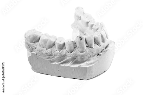 Denture gypsum model isolated on white background.