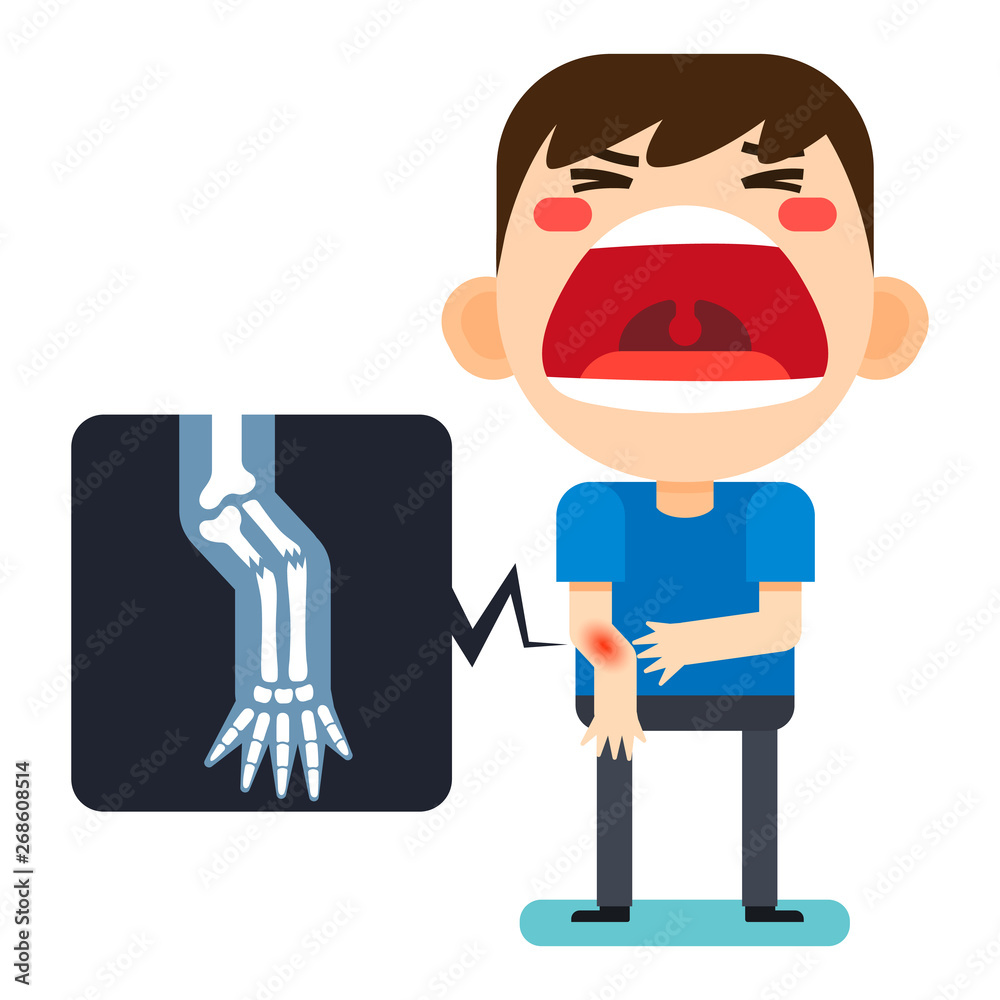 Tiny cute man character broken right arm and x-ray_v2 Tiny cute man character broken right arm and x-ray_v2