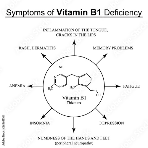 Symptoms of vitamin B1 deficiency. Infographics. Vector illustration on an isolated background.