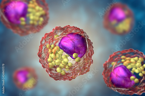 Foam cells, macrophage cells that contain lipid droplets and are components of atherosclerotic plaque, 3D illustration photo