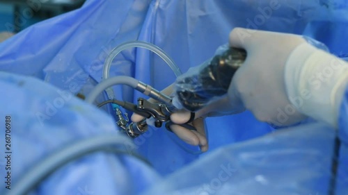 Close-up of surgeon hands performing laparoscopic surgery
