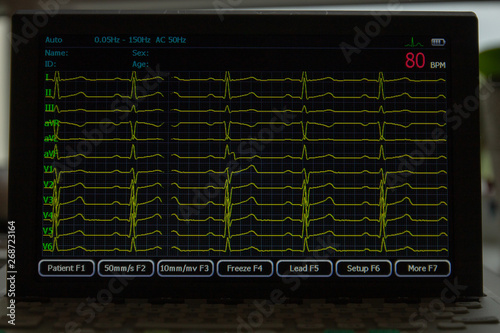 Konstfotografi Screen of electrocardiograph device showing twelve yellow ECG cardiography rythm leads