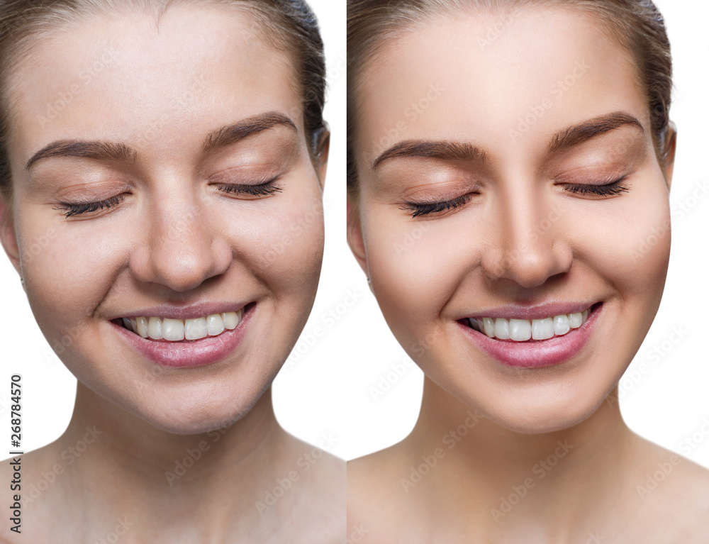 Comparison portrait of young woman before and after retouch. Comparison portrait of young woman before and after retouch.