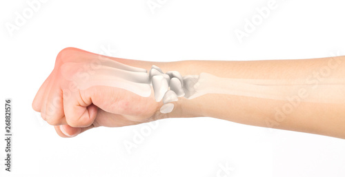 wrist bones injury white background wrist pain
