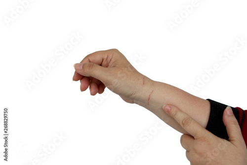 hand of a woman with fresh deep scratches, wounds, isolated on white backround, copy space