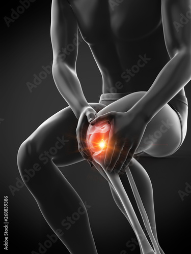 3d rendered medically accurate illustration of a mans painful knee