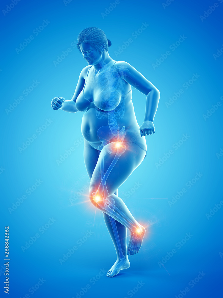 3d rendered medically accurate illustration of an overweight womans painful joints 3d rendered medically accurate illustration of an overweight womans painful joints