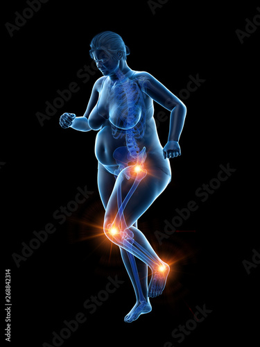 3d rendered medically accurate illustration of an overweight womans painful joints