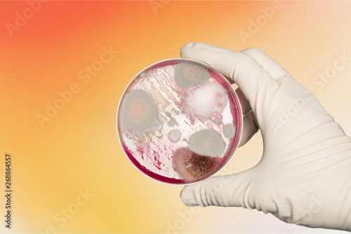 Microbiology laboratory test in scientist hand