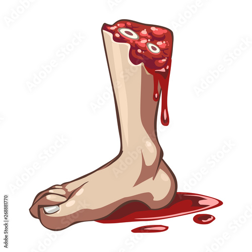 Cartoon vector severed bleeding leg with blood puddle