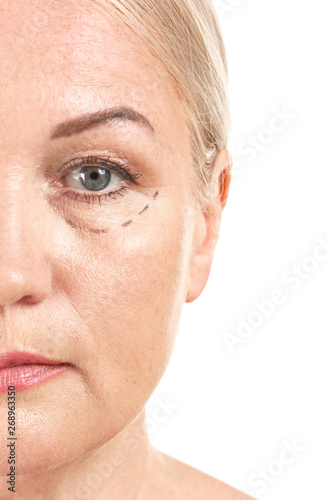 Mature woman with marks on ...
