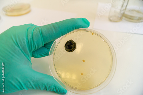Mold grown on a Sabouraud agar medium in a Petri dish