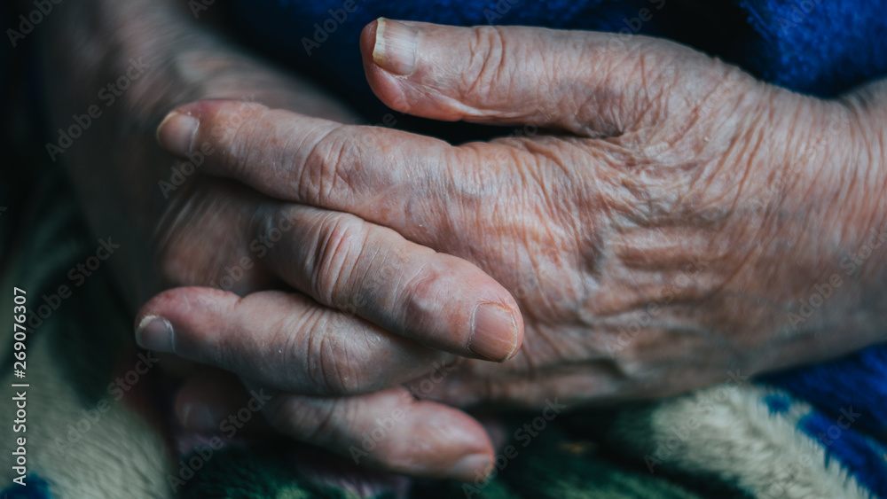 Fototapeta premium old senior woman hands with veins. risk group coronavirus or covid virus. risk group coronavirus or covid virus