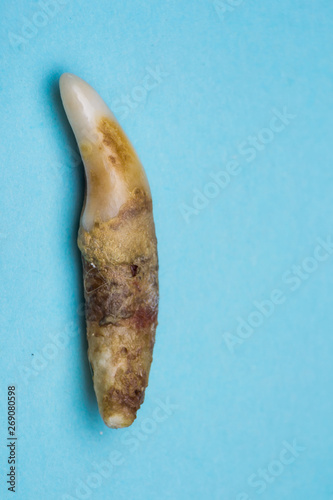 dog tooth with bacterial plaque isolated on blue background