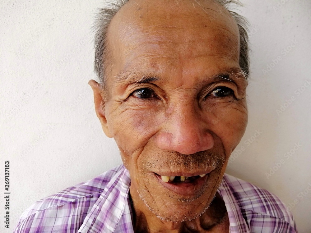 Old man .. Bald head, white hair, thin hair, wrinkled face, decayed tooth,  broken teeth ... Everything is aging, but still has a happy eye. Stock  Photo | Adobe Stock