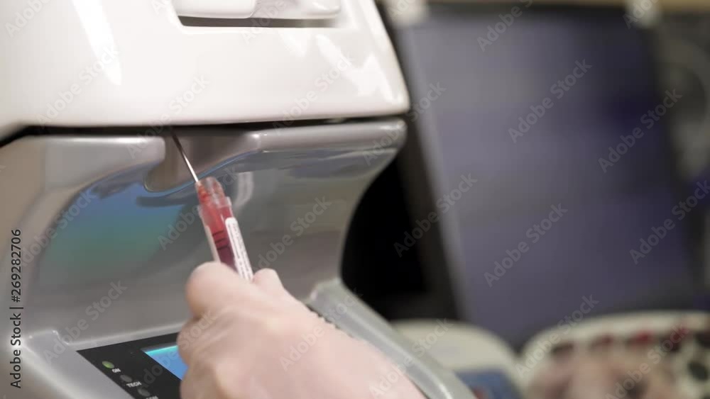 A close-up demonstration video of a hematology analyzer usage. Laboratory vessels and devices are used for preparation and manipulation with liquids.