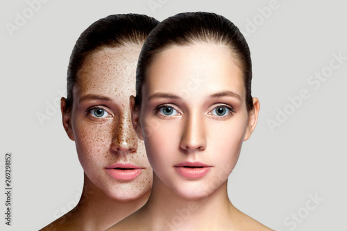 Fotografija Closeup portrait of beautiful brunette woman with and without freckles on face