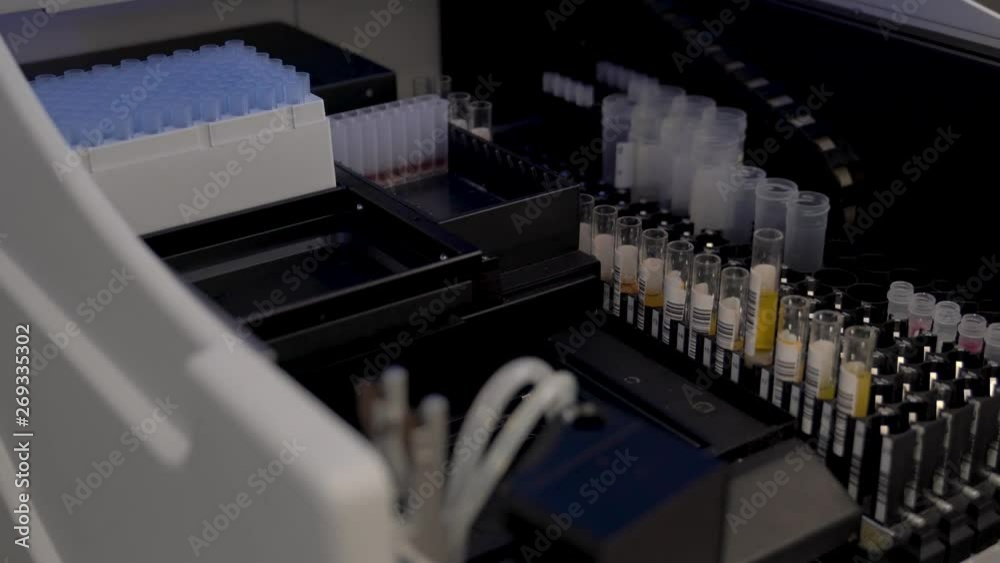 A close-up of medical technologists hand holding racks with blood tubes ...