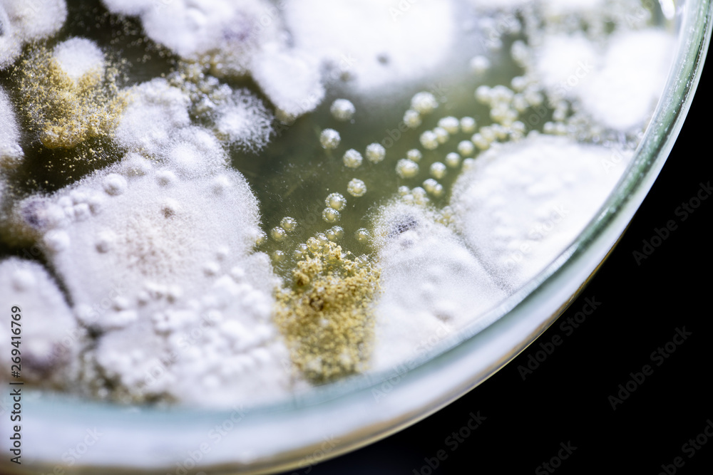 Mold Beautiful, Colony of Characteristics of Fungus (Mold) in culture medium plate from laboratory microbiology. Mold Beautiful, Colony of Characteristics of Fungus (Mold) in culture medium plate from laboratory microbiology.