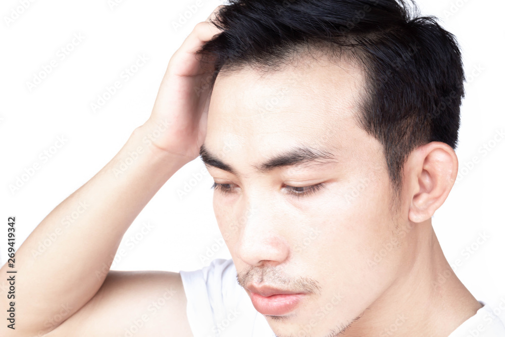 Young man serious hair loss problem for health care medical and shampoo product concept Young man serious hair loss problem for health care medical and shampoo product concept