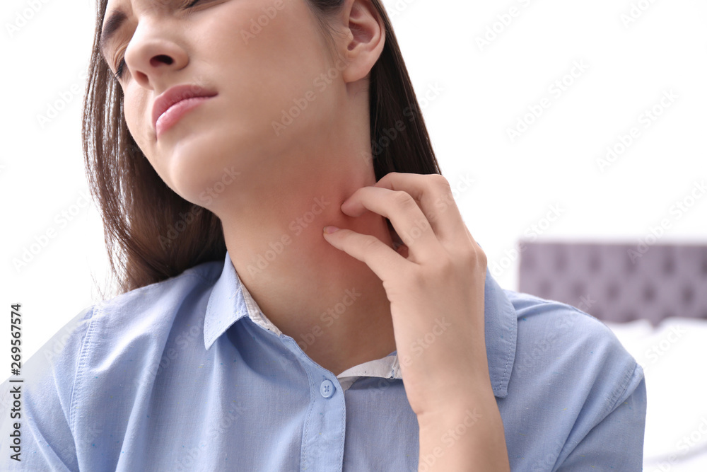 Young woman scratching neck indoors, closeup. Allergies symptoms Young woman scratching neck indoors, closeup. Allergies symptoms