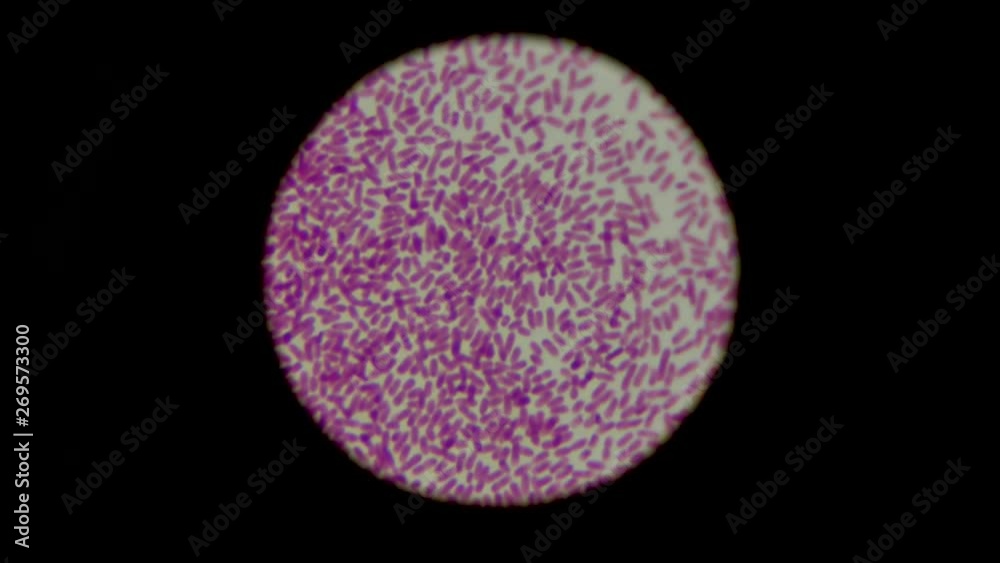 Candida fungus spores under microscope. Candida microorganisms ...