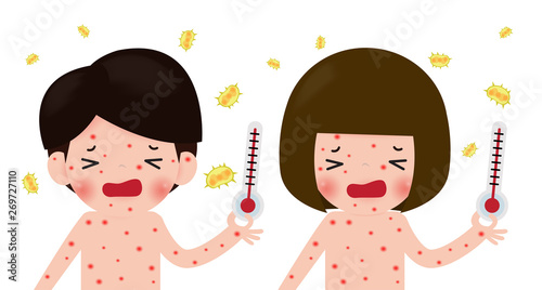 Children has chicken pox , kids fever and chickenpox symptoms and prevention. sick man and woman with fever and red rash, boy and girl Measles,Health care cartoon character vector illustration
