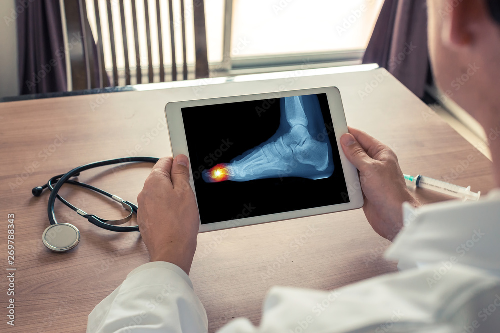 Fototapeta premium Doctor holding a digital tablet with x-ray of foot and pain on the toe