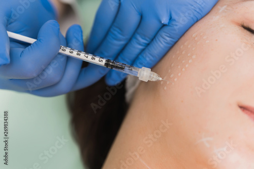Mesotherapy treatment photo
