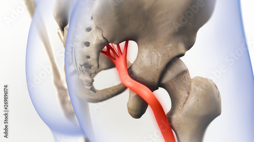 Sciatic Pinched Nerve Pain Illustration