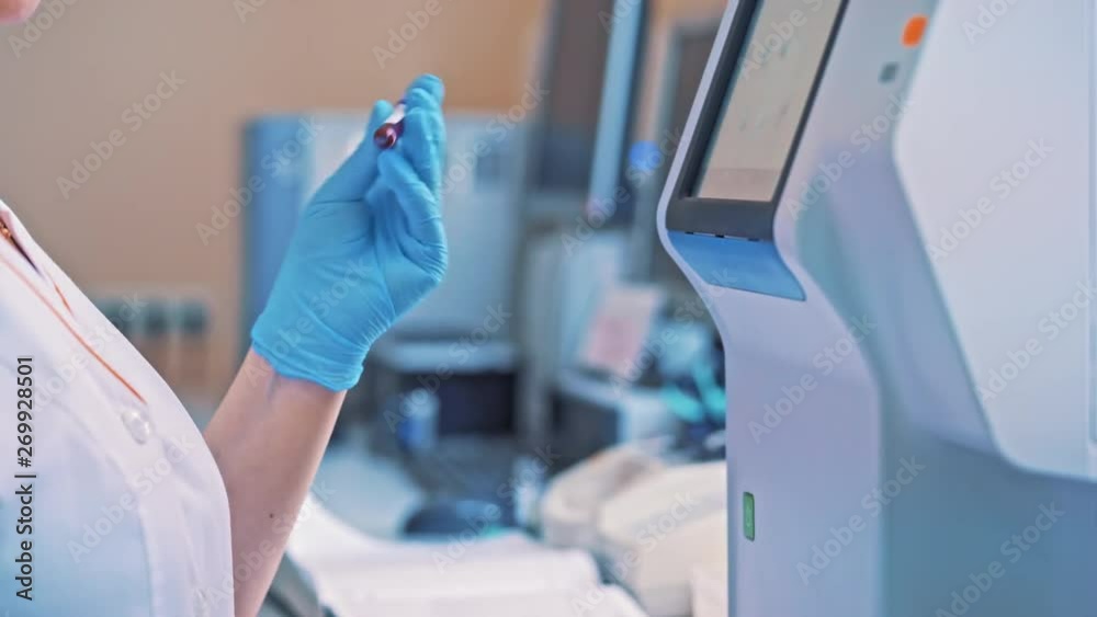 Laboratory worker holds a vial and mixes it by hand in hospital. Technician woman works with blood samples while standing close to the automated machine in clinic. Close-up.
