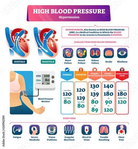 High blood pressure vector illustration. Labeled systole explanation scheme photo