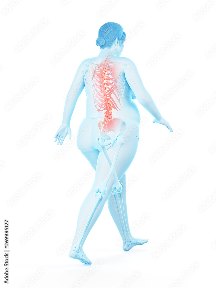 3d rendered medically accurate illustration of an obese womans 3d rendered medically accurate illustration of an obese womans