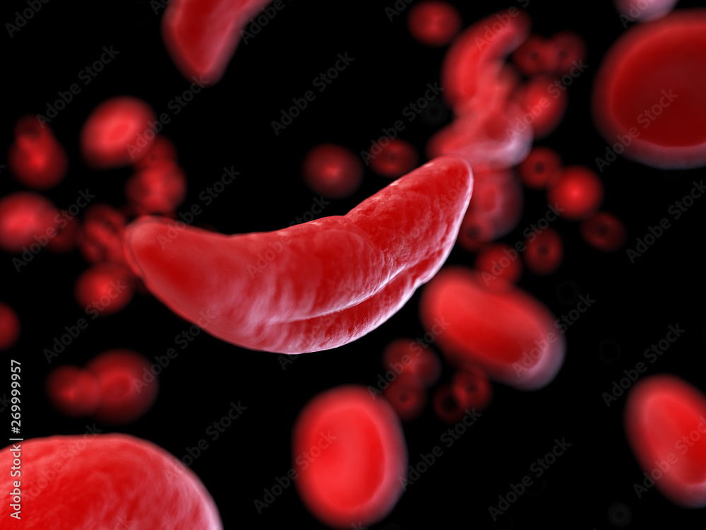 Ταπετσαρία 3d rendered medically accurate illustration of sickle cells