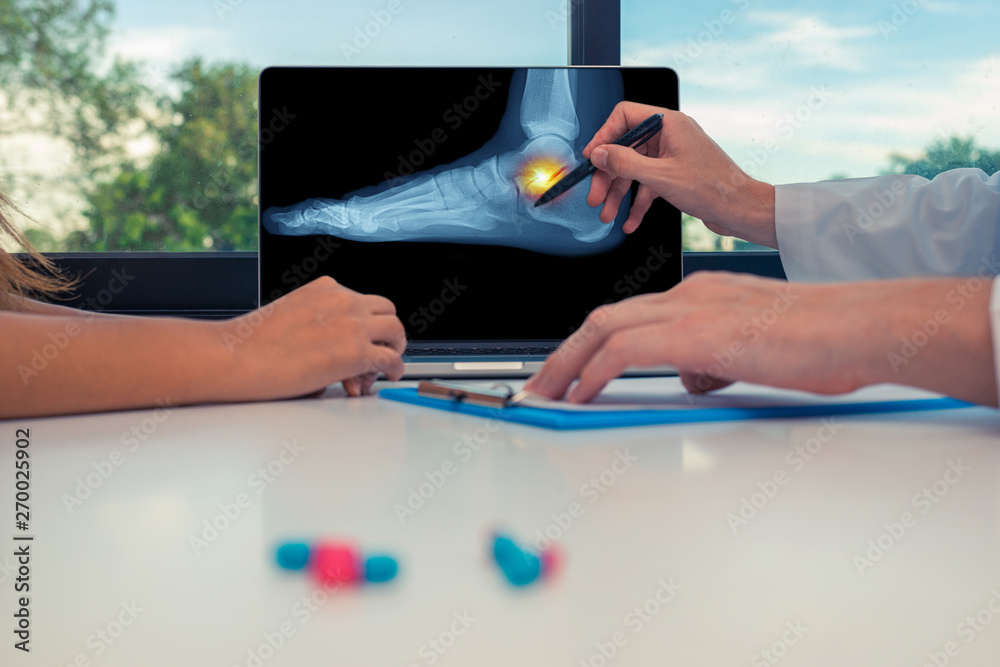 Φωτογραφία Doctor showing a x-ray of a foot and pain on the ankle on a laptop to a woman patient