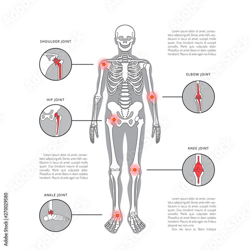 joint pain vector body parts with pain ring
