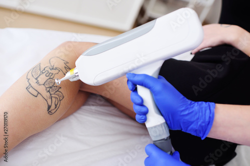 the cosmetologist removes the tattoo on the leg of a young pretty girl with a laser. Laser cosmetology