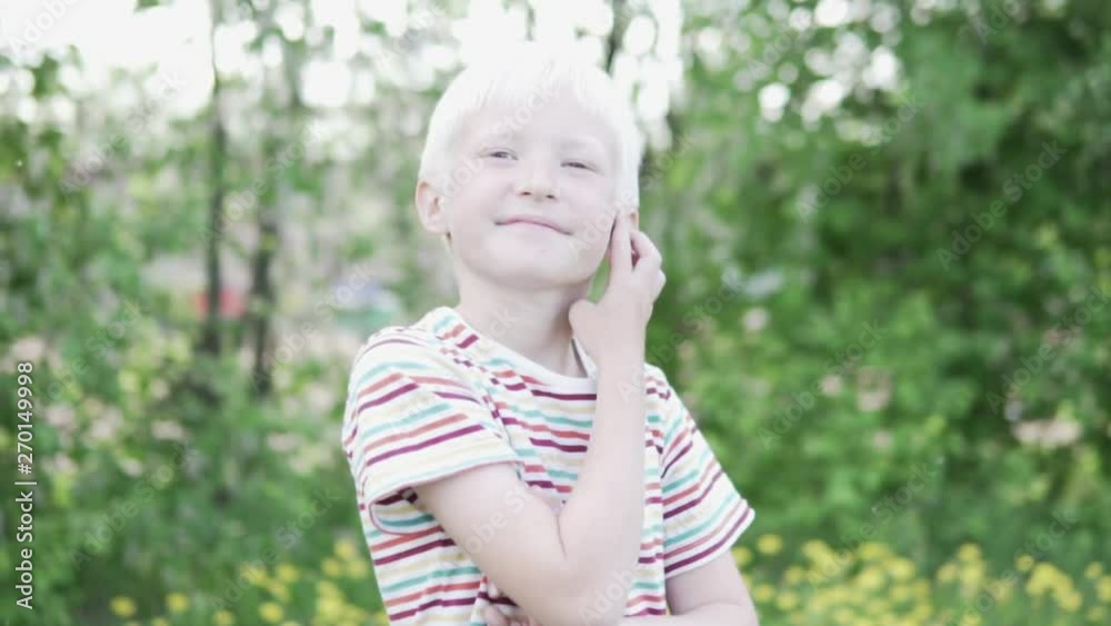 Handsome albino boy walking in the park on a summer day. Handsome albino boy walking in the park on a summer day.