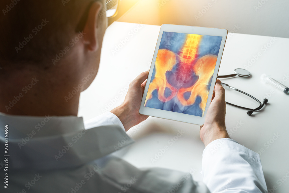 Doctor holding a digital tablet with x-ray of hips Doctor holding a digital tablet with x-ray of hips
