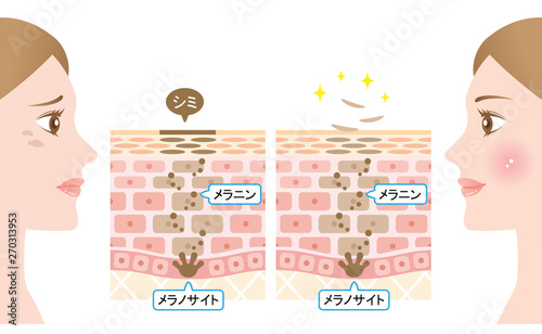 ターンオーバー　肌の断面図と女性