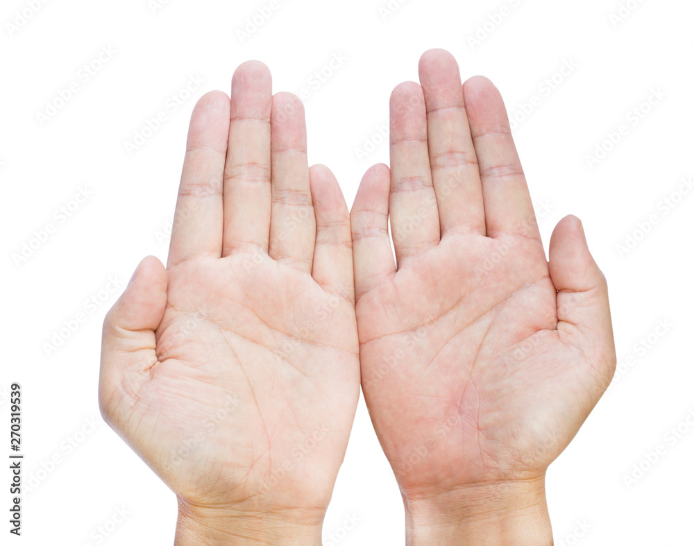 clinodactyly fingers isolated on white background isolated fifth finger clinodactyly Dupuytren disease and Disabled Hands clinodactyly fingers isolated on white background isolated fifth finger clinodactyly Dupuytren disease and Disabled Hands